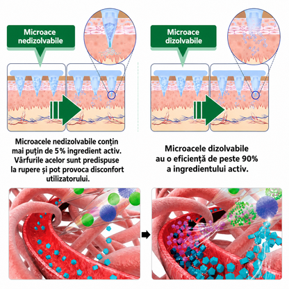 🧑‍⚕️ Plasture nano cu microace 10-în-1 pentru susținerea metabolismului cu Moringa × Berberină × AMPK 🇷🇴